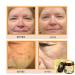 Hacaus Bee Venom Comprehensive Cream 2025 New Skincare Treatment Bee Venom Skin Cream Visibly reduces skin blemishes Natural Skin Moisturizer for Face and Body - Buy Online on GoSupps.com