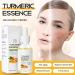 Turmeric Face Serum - Dark Spot Correcting Glow Serum - Turmeric Essence for Skin Lig_htening - Dark Spot Remover Face Serum for All Skin Types - Anti Wrinkle Face Serum - 30ml - Buy Online on GoSupps.com