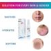 OXILVER SKIN Solution for Antiaging & Care of Dry Red Atopic Inflammed Acne-prone Skin Active Oxygen Ionized Silver Aloe vera Hyaluronic Acid 100 ml  - Buy Online on GoSupps.com