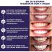 AriNoy Premium Whitening Strips - 40 Safe Teeth Whitening Strips for Effective Enamel Care | International Shipping Available - Buy Online on GoSupps.com