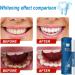 Teeth Whitening Pen Teeth Whitening Gel for Sensitive Teeth and Gums Instant Teeth Whitening Pen Teeth Stain Remover Teeth Whitener - Buy Online on GoSupps.com