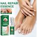 FASSME Nail Repair Essence toenail solution nail repair nursing solution of gray nails safe and effective repair discolored damaged nails 10ml - Buy Online on GoSupps.com