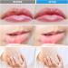 Lawind Cold Sore Treatment: Red Light Therapy for Pain Relief on Lips, Face, Body - Oral, Nose, Ear and Joint Inflammation Solution - Buy Online on GoSupps.com
