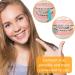 100 Pcs Colorful Dental Elastic Rubber Bands for Orthodontic Braces - Plastic Placers Tool for Effective Tooth Alignment - Buy Online on GoSupps.com