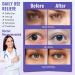 Serfeymi 16-Pack Self-Heating Steam Eye Masks for Sleeping - Lavender & Chamomile | Disposable Eye SPA Mask for Mother's Day Gifts - Buy Online on GoSupps.com