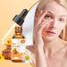 Shop Honey Eye Drops - Moisturize Eyes & Relieve Fatigue | Stingless Bee Honey (2 pcs) - International Shipping Available - Buy Online on GoSupps.com