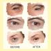 Snail Essence under Eye Cream - Ball Design Eye Bags Remover - Eye Cream for Dark Circles and Puffy Eyes - Anti Aging Eye Cream Tightening Lifting Sagging Skin - Repairing Skin - Buy Online on GoSupps.com