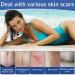 Silicone Scar Sheets (1.6 x 120 Roll) - Medical Grade Scar Tape for Acne, C-Section & Keloid Scars - Buy Online on GoSupps.com