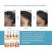For curly hair 30 ml drops for scalp and density | For hair growth to moisturize prevent breakage loss and thinning promotes thickness for women - Buy Online on GoSupps.com
