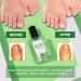 Skinapeel Toe Nail Softener and Ingrown Toenail Treatment Oil - Solution for Hard Thick Cracked Nails - Buy Online on GoSupps.com