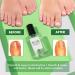 Skinapeel Toe Nail Softener & Ingrown Toenail Treatment Oil with Corrector Tool - Buy Online on GoSupps.com