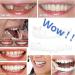 Upper and Lower Veneer Dentures for Women and Men - Natural Shade Fake Teeth - Instantly Fix Your Smile at Home! - Buy Online on GoSupps.com