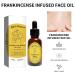 LOYOTICE 2PC Frankincense Resin Oil Infused Organic Black Seed Castor & Jojoba Oils for Face Anti-Aging Miracle Facial Moisturizer Anti-Wrinkles Natural Skincare Hydrates Skin(30ml) - Buy Online on GoSupps.com