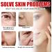S rum Aux Cellules Souches Pour Le Visage Micro-Infusion Pour Les Soins De La Peau Lifting Anti-Rel chement Cutan Anti-Rides Anti- ge - Buy Online on GoSupps.com