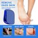 2-in-1 Nano Glass Corn Remover | Wet & Dry Foot Care Tool for Safe & Quick Removal of Dead Skin Calluses & Cracked Heels - Buy Online on GoSupps.com
