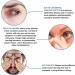 EXQST Soothing Eye Ointment 20g Rehydrates and Rejuvenates Dry Eyes Night Ointment for Dry Eyes Soothes Eyes Reduces Redness and Eye Pain - Buy Online on GoSupps.com