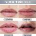 Ginger Lip Lightening Cream Lip Lightening For Dark Lips Lip Balm Lips Pink Bleaching Cream Balm Long Lasting Moisturizing Lip Care Cream Nourishes Lips Ginger Lip Lightening for Dark Lips - Buy Online on GoSupps.com