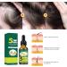 Shantou Yingji 2 pieces ginger hair growth oil ginger hair growth essential oil ginger hair treatment oil solution for hair growth essential oil against hair loss 2 pieces x 30 ml hair2 pieces - Buy Online on GoSupps.com