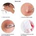 ZIZZON Blackhead Remover Tool - Stainless Steel Acne Extractor Kit - Buy Online on GoSupps.com