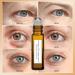 Time Eraser Rollerball with 100% Organic Castor Oil & Frankincense - Anti-Wrinkle Serum for Eyes Reduces Fine Lines (2 PCS) - International Shipping - Buy Online on GoSupps.com