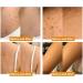 ZVLZVL Bee Venom Cream - Repair & Remove for Men & Women | 1 Fl Oz | International Shipping - Buy Online on GoSupps.com
