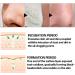 QEEROYO Nose Pore Strips Nose Strips Nose Strips Blackhead Black Head Remover For Nose Blackhead Mask Blackhead Nasal Membranes Head Remover For Nose Blackhead Remover for All Skin Types 30g - Buy Online on GoSupps.com