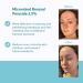 MDacne Benzoyl Peroxide Cream 2.5% for Acne Treatment - Unclogs Pores, Reduces Blemishes, and Enhanced with Plant-Based Ingredients for Sensitive Skin - Buy Online on GoSupps.com