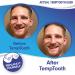 Temptooth: #1 Trusted Patented Temporary Tooth Replacement - Buy Now! - Buy Online on GoSupps.com