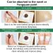 40PCS Wormwood & Mugwort Belly Patch + Moxibustion Patch Set for Herbal Abdominal Relief - Men & Women - Buy Online on GoSupps.com