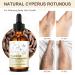 Cyperus Rotundus Oil Cyperus Rotundus Oil for Hair Removal Natural Moisturizing Cyprus for Smooth Skin Suit for All Skin Type - Buy Online on GoSupps.com