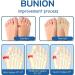 LXCJZY Orthoes Bunion Relief Socks | Anti-Bunion Split Toe Compression Socks - Pink (10 Pairs) - Buy Online on GoSupps.com