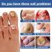 Keratin Nail Growth Oil Nail Strengthener for Damaged Nails - Buy Online on GoSupps.com