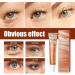 Milia Removal Eye Creams Milia Spots Removal Eye Cream Milia Remover Firming Anti Wrinkle Whitening Eye Cream Smooth Milia Eyes Cream Milia Spot Care Cream 15g - Buy Online on GoSupps.com