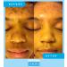 Admire My Skin Dark Spot Corrector Serum + Retinoid Cream Set - Buy Online on GoSupps.com