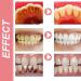 BioDental Harmony Toothpaste BioDental Probiotic Whitening Toothpaste Freshens Breath and Removes Stains - Buy Online on GoSupps.com