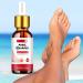 Nail Fungus Treatment for Toenail - 7 Day Fungal Nail Treatment for Toenails Extra Strong - Fungal Nail Treatment - Toenail Fungus Treatment for Thickening Yellow-Brown Discoloration Ragginess 10ML - Buy Online on GoSupps.com