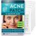Acne Pimple Patches - Dark Spot, Blemish, Zit Treatment - 54% Hydrocolloid Dot Stickers - 120 Patch Pack for Clean Skin - Hyaluronic Salicylic Acid, Tea Tree Oil, Vitamin A - Face Cystic Pore Covers 120 Count (Pack of 1)