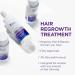 Head & Shoulders Scalp X 2% Minoxidil for Women - Hair Regrowth Treatment Thinning Hair & Hair Loss Solution 3 Month Supply (3 x 2 Fl Oz - Buy Online on GoSupps.com