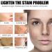 Dark Spot Remover Hyperpigmentation Treatment Dark Spot Corrector for Face Freckle Remover Cream Age Spots & Sunspots & Melasma Cream Even Skin Tone Moisturizing Erase Fine Lines Firming - Buy Online on GoSupps.com