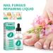 Kerassentials Toenail Treatment Oil - Repair Damaged and Discolored Nails - Buy Online on GoSupps.com