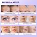 Forehead Wrinkle Patches Face Wrinkle Patches for Face Overnight Face Wrinkle Patches for Forehead Wrinkles Treatment Face Smoothing Patches Anti Wrinkle Patches Wrinkle Remover Strips/840 - Buy Online on GoSupps.com