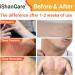 Buy Tinea Versicolor Treatment - Effective Antifungal Cream for Ringworm & Skin Irritation | 3.53 Oz - Buy Online on GoSupps.com