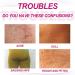 Cr me Dissolvant de Boutons pour les Fesses Cr me pour les Boutons des Fesses Lotion de Compensation de l'acn 100ml - Buy Online on GoSupps.com