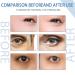 HIMEYE Peptide Depuffing Eye Serum & Gel - Firming Anti-Wrinkle Eye Cream for Dark Circles & Under Eye Bags (5PCs) - Shop Internationally - Buy Online on GoSupps.com