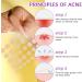 192 Pieces Pimple Patches Pimple Patches Pimple Patches Invisible Pimples Hydrocolloid Acne Pimple Treatment Anti Acne and Anti Blemish Day Face Can Get Rid of Acne Fast - Buy Online on GoSupps.com