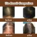 wimony Batana Oil Organic Batana Oil For Hair Growth 100% Pure Raw Natural Batana Oil for Healthy Hair Batana Oil Hair Treatment Promotes Hair Growth Smoother and Shinier Thicker Improve Hair Loss(1PC - Buy Online on GoSupps.com