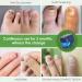 Home-Use Nail Fungus Laser Device with LED Blue Light Therapy - Buy Online on GoSupps.com
