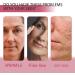 Cr me Visage Hydratante Au Collag ne - Hydratant Anti-rides For Les Ridules L' lasticit De La Peau Et L' clat De Jeunesse Lotion Visage Nourrissante En Profondeur(2PCS) - Buy Online on GoSupps.com