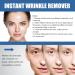 Retinol Collagen Cream with 5% Hyaluronic Acid Retinol Face Cream with Collagen Anti Wrinkle Face Cream Anti Aging Face Cream Retinol Serum for Face Night Moisturiser Day Cream for Women Anti Aging - Buy Online on GoSupps.com