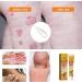 EXQST Bee Venom Psoriasis Treatment Cream - Professional Anti-Itch & Soothing Moisturizer (5pcs) - Buy Online on GoSupps.com